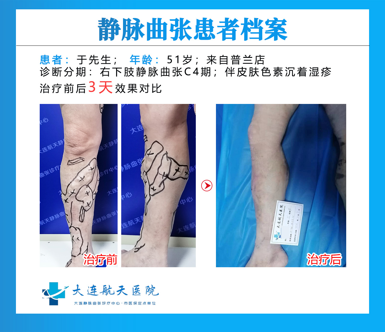 于忠党术后3天