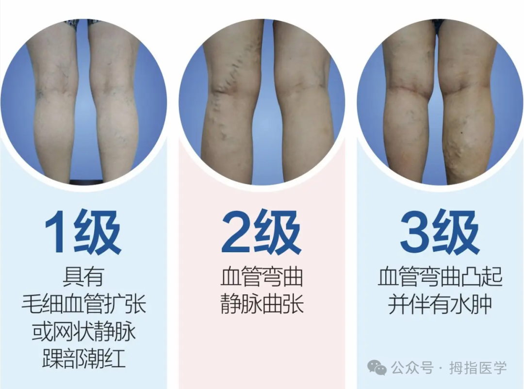 等1