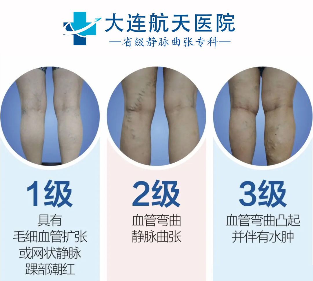 等级1