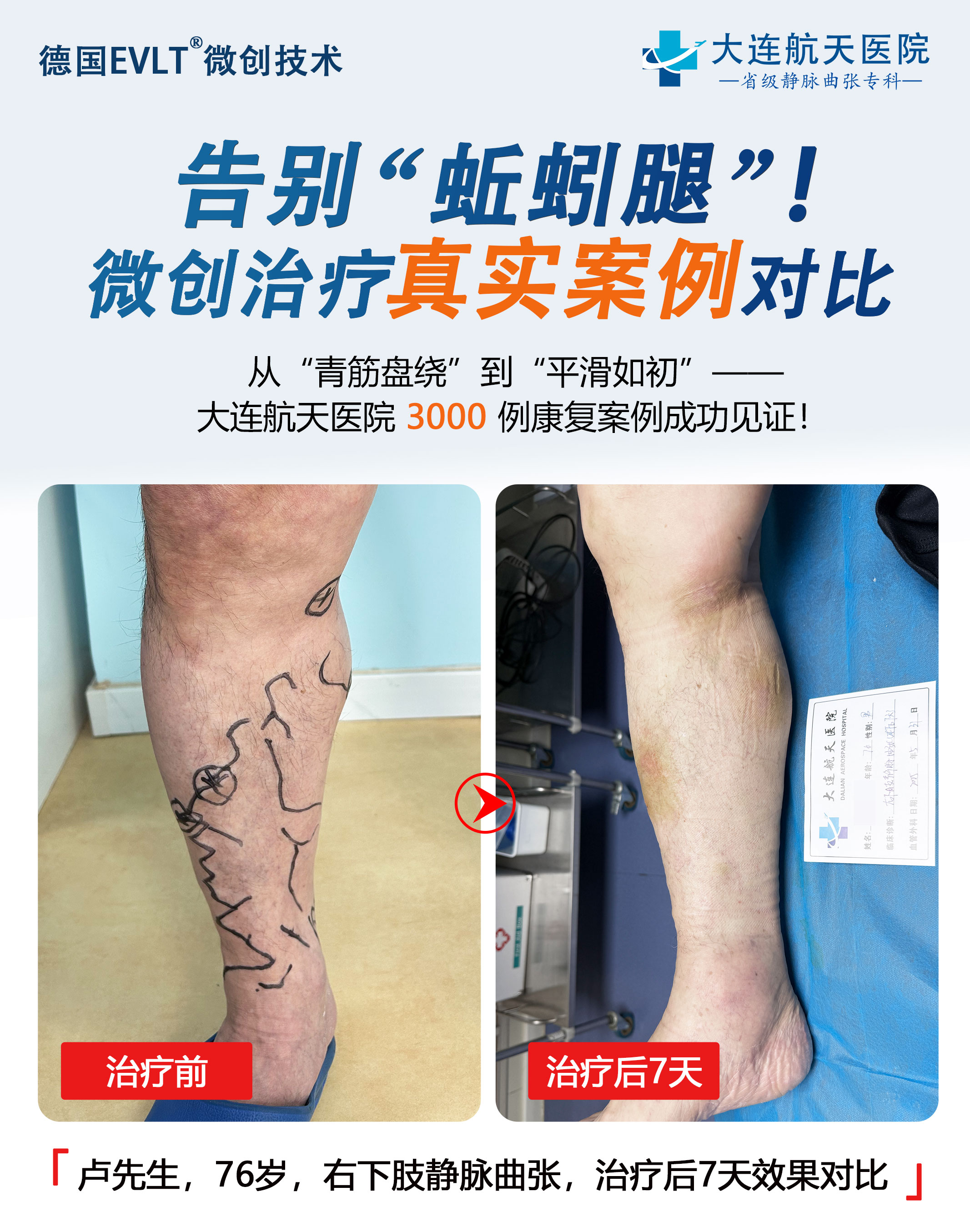 大连卢福生7天对比