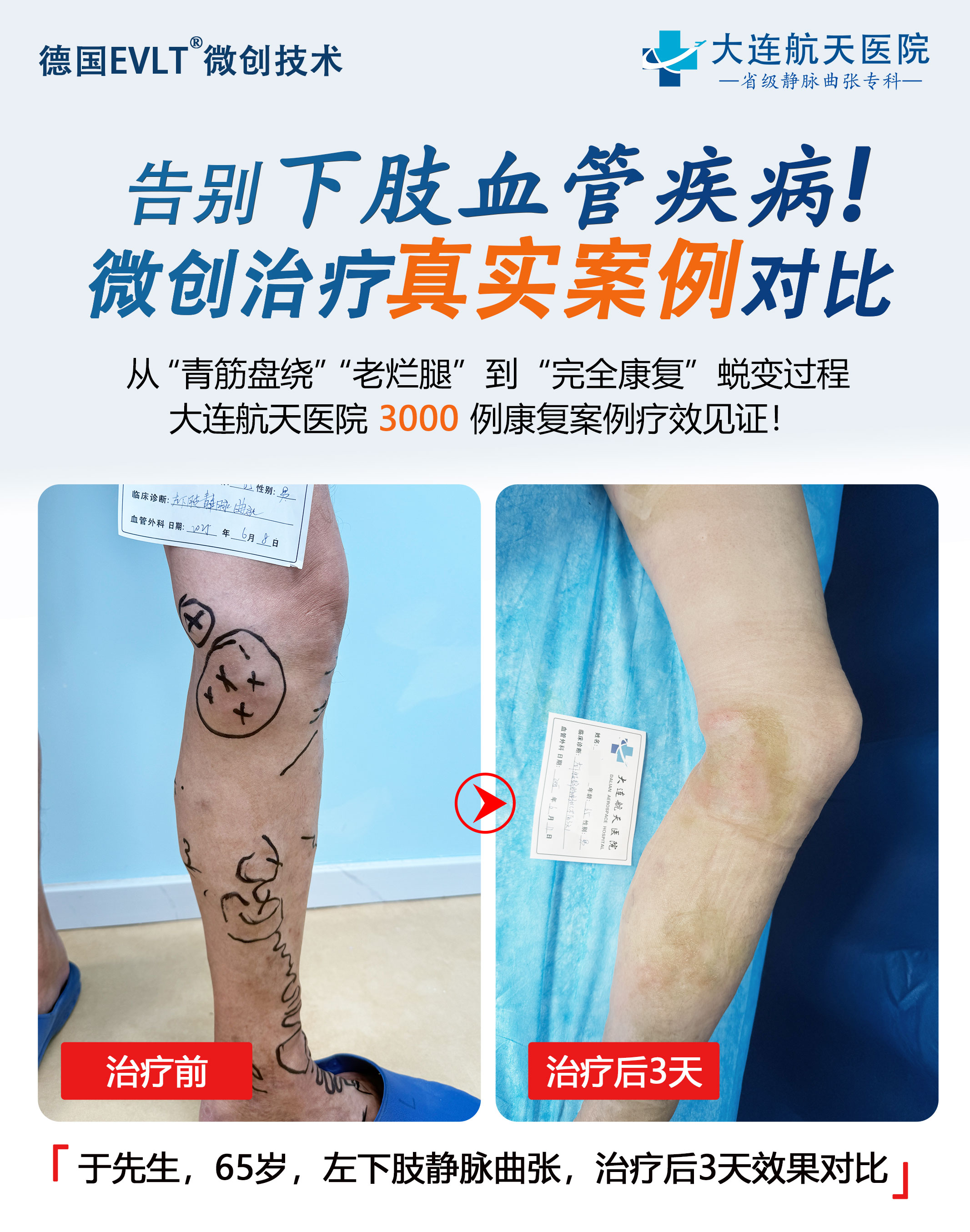 大连于炜对比