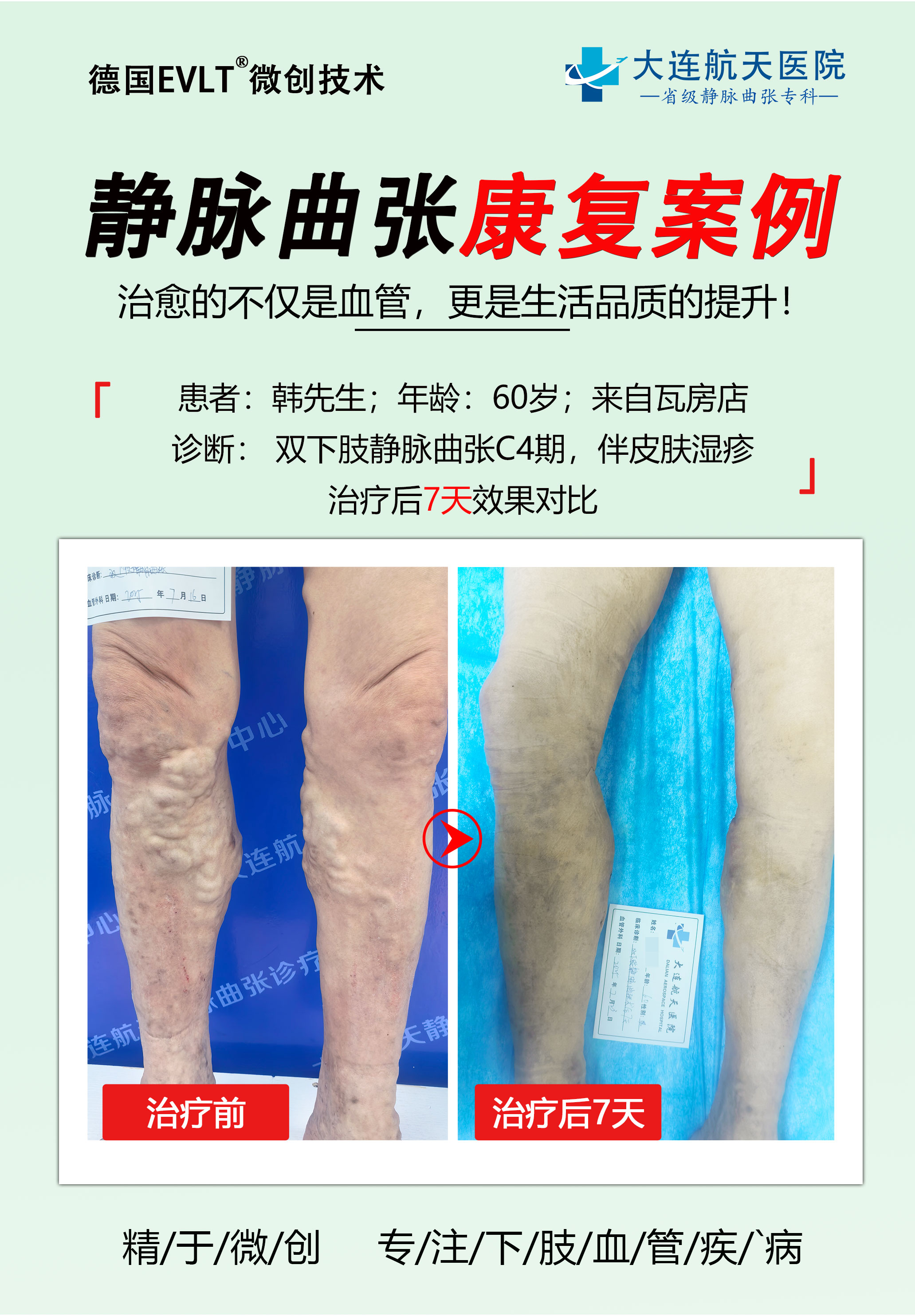 acbdd57762c5125869fb6cbee7fda15