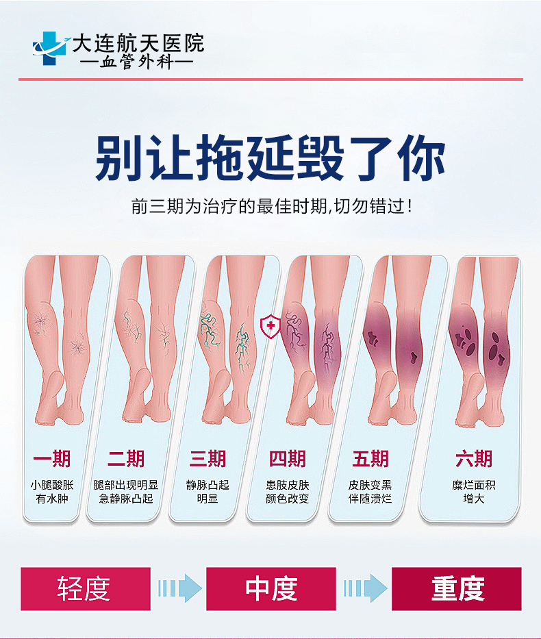 别让静脉曲张拖延大连