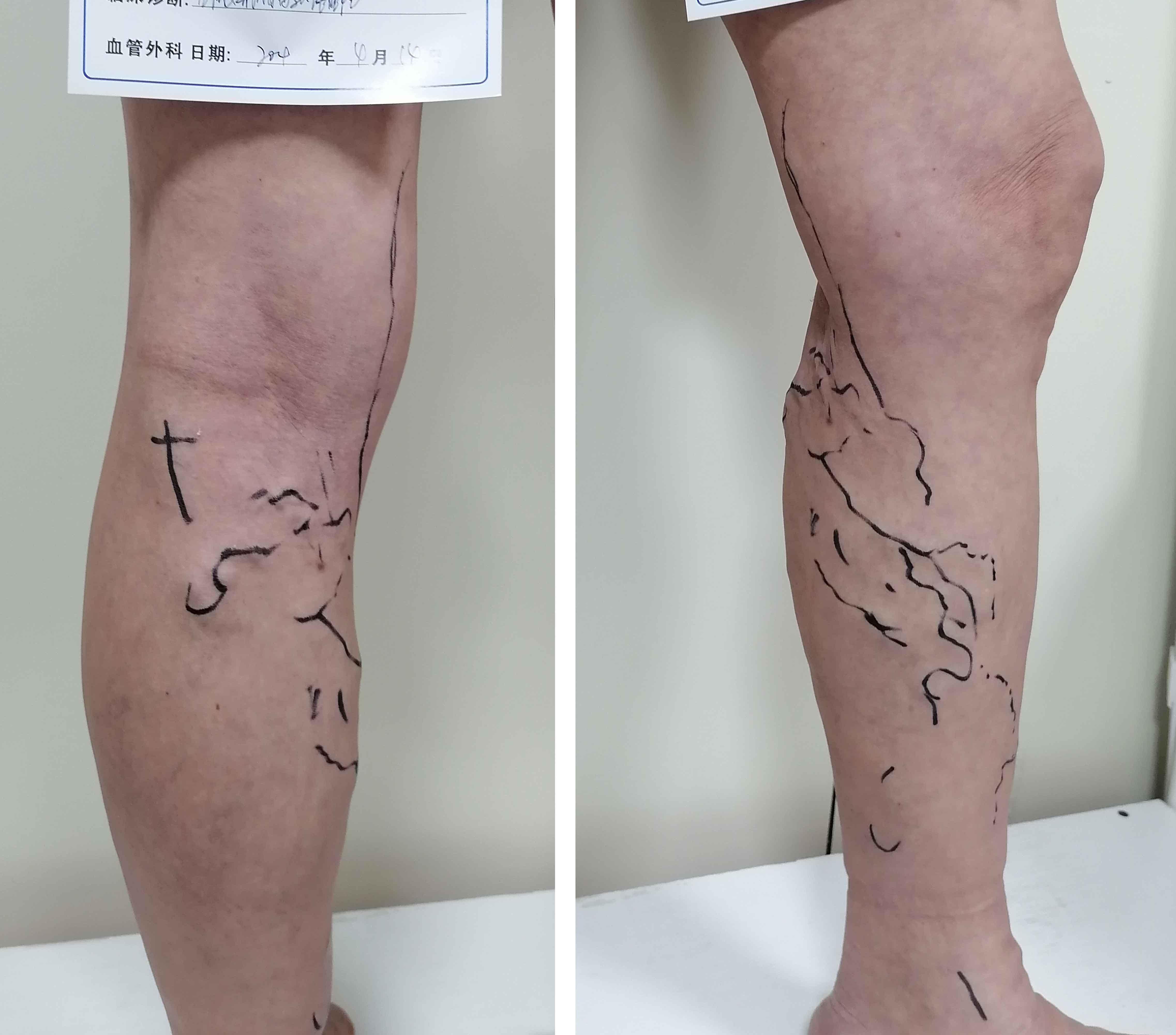 夏至将到，乐山肛肠医院为你介绍夏至必备食物(图1)